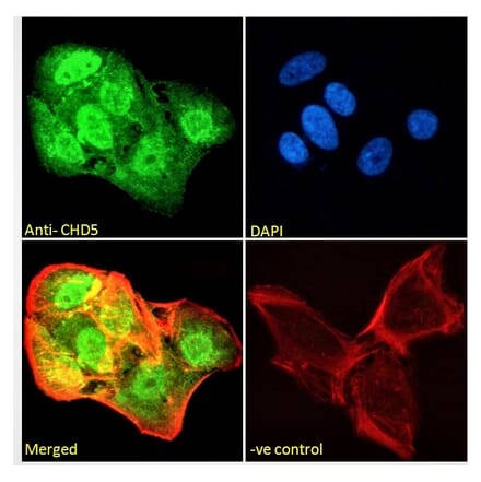 Immunofluorescence - Anti-CHD5 Antibody (A285975) - Antibodies.com