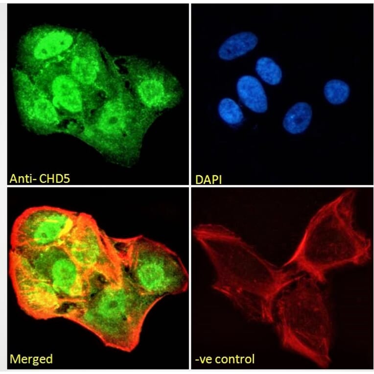 Immunofluorescence - Anti-CHD5 Antibody (A285975) - Antibodies.com