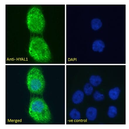Immunofluorescence - Anti-HYAL1 Antibody (A285977) - Antibodies.com