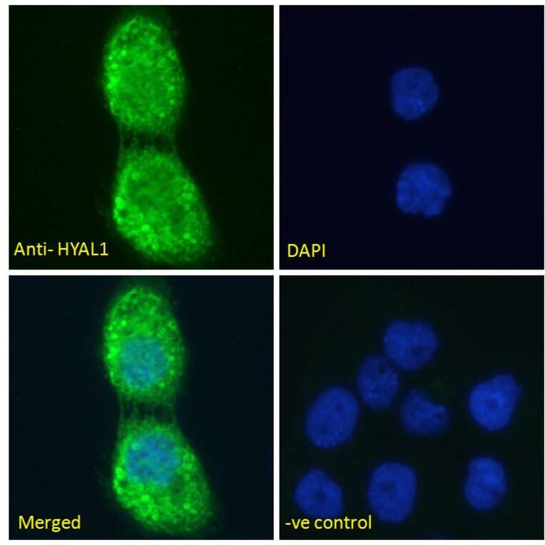 Immunofluorescence - Anti-HYAL1 Antibody (A285977) - Antibodies.com