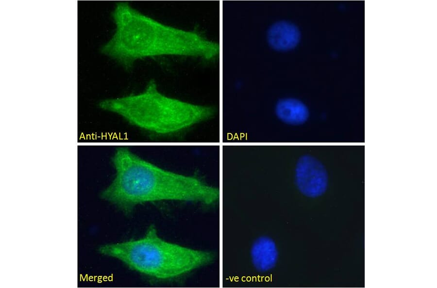 Immunofluorescence - Anti-HYAL1 Antibody (A285977) - Antibodies.com