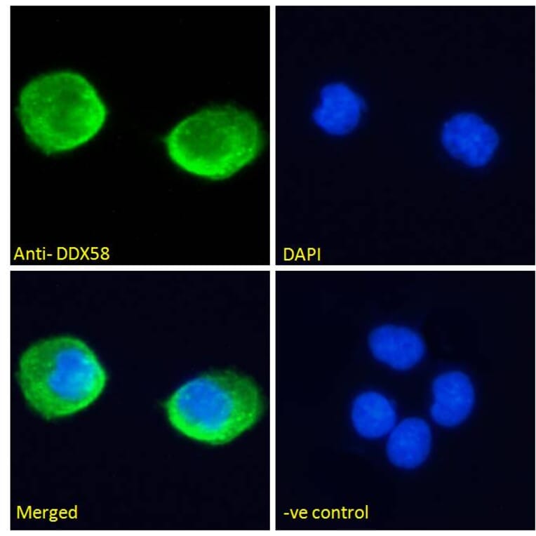 Immunofluorescence - Anti-RIG-I/DDX58 Antibody (A285978) - Antibodies.com