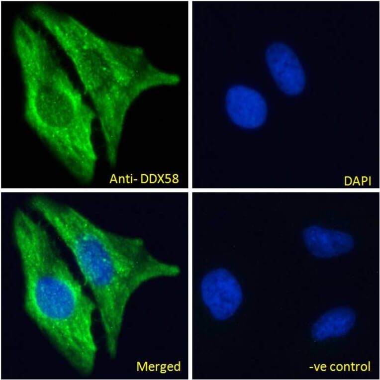 Immunofluorescence - Anti-RIG-I/DDX58 Antibody (A285978) - Antibodies.com