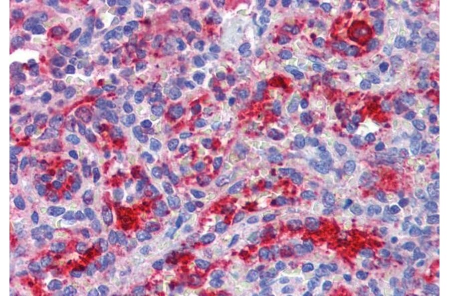 Immunohistochemistry - Anti-RIG-I/DDX58 Antibody (A285978) - Antibodies.com