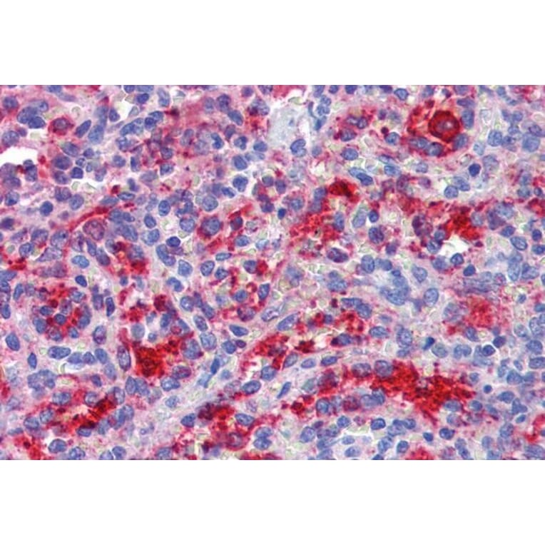 Immunohistochemistry - Anti-RIG-I/DDX58 Antibody (A285978) - Antibodies.com
