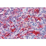 Immunohistochemistry - Anti-RIG-I/DDX58 Antibody (A285978) - Antibodies.com