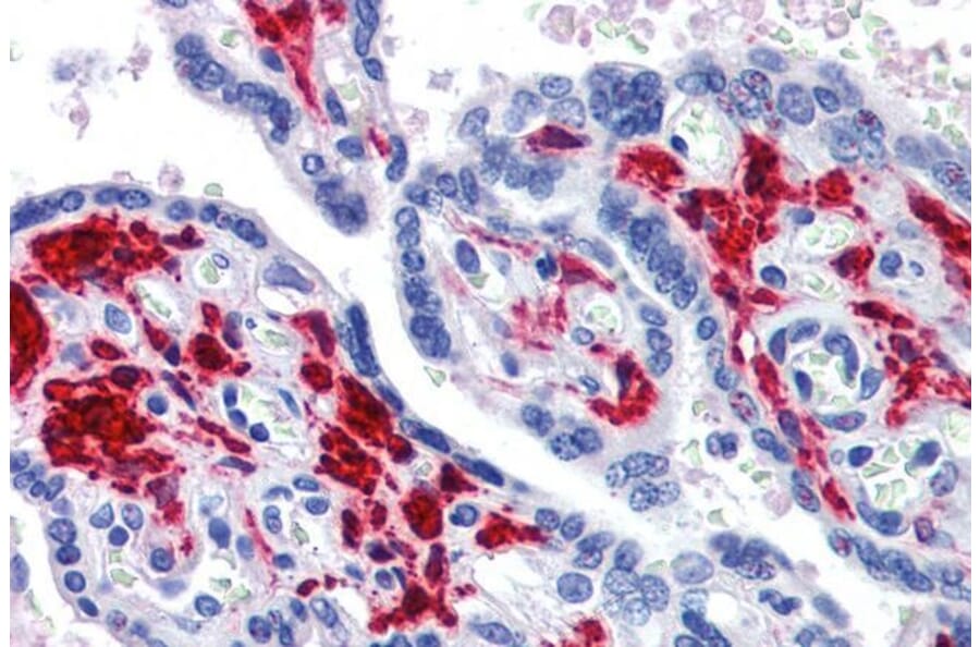 Immunohistochemistry - Anti-RIG-I/DDX58 Antibody (A285978) - Antibodies.com