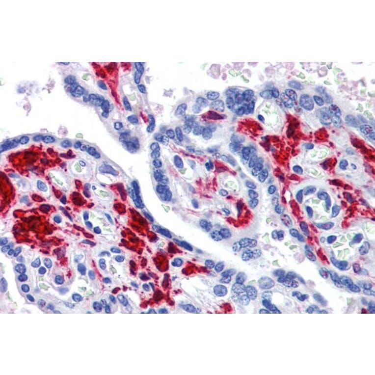 Immunohistochemistry - Anti-RIG-I/DDX58 Antibody (A285978) - Antibodies.com