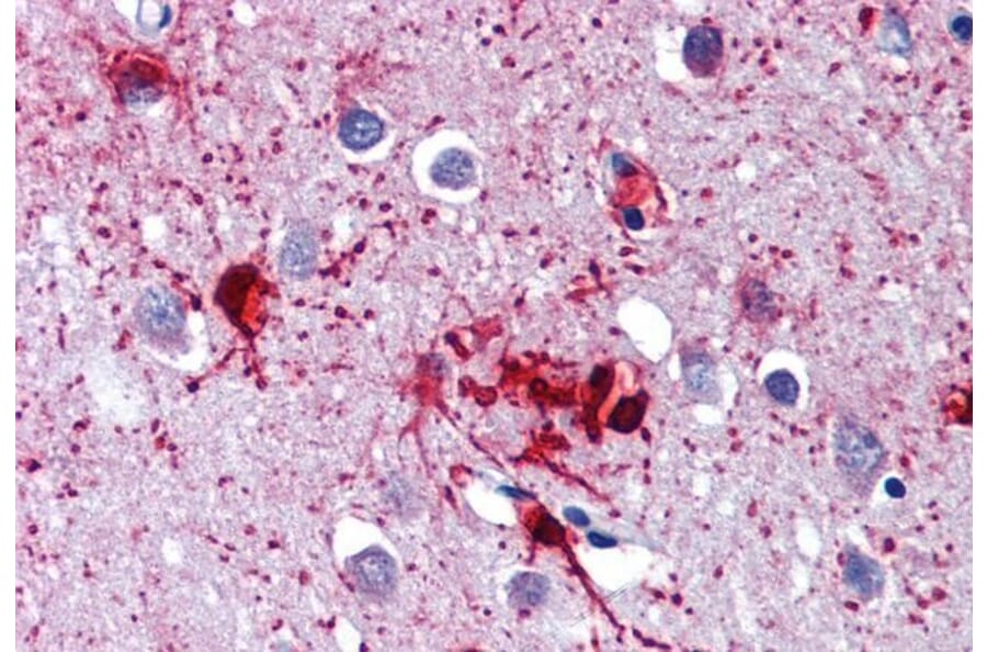 Immunohistochemistry - Anti-RIG-I/DDX58 Antibody (A285978) - Antibodies.com