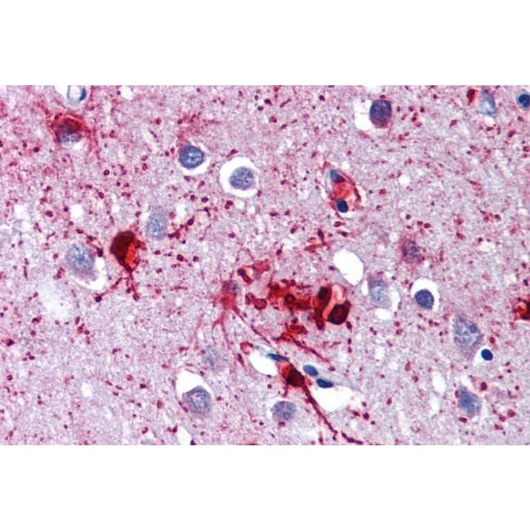 Immunohistochemistry - Anti-RIG-I/DDX58 Antibody (A285978) - Antibodies.com