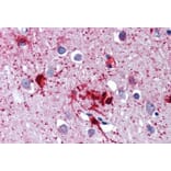 Immunohistochemistry - Anti-RIG-I/DDX58 Antibody (A285978) - Antibodies.com