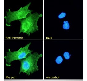 Immunofluorescence - Anti-Hornerin Antibody (A285984) - Antibodies.com