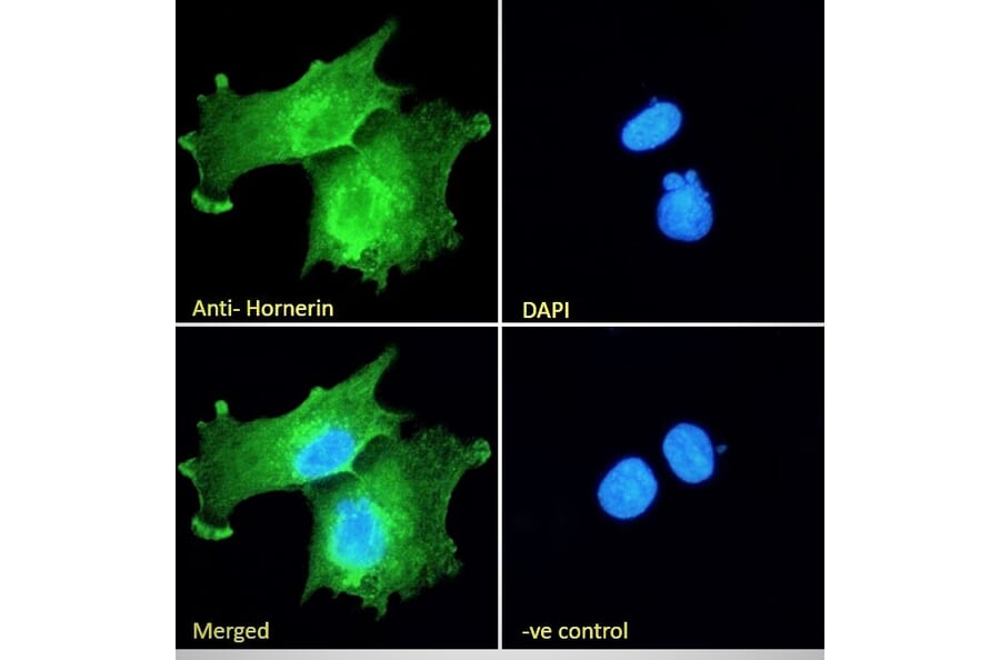 Immunofluorescence - Anti-Hornerin Antibody (A285984) - Antibodies.com