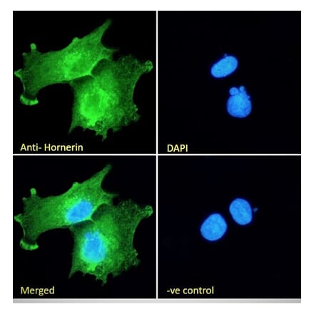 Immunofluorescence - Anti-Hornerin Antibody (A285984) - Antibodies.com