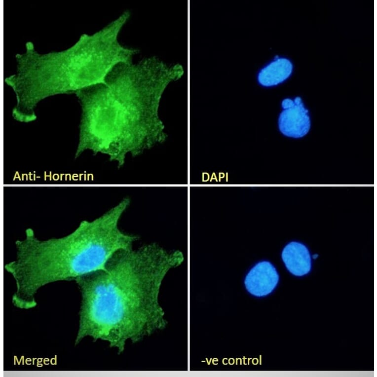 Immunofluorescence - Anti-Hornerin Antibody (A285984) - Antibodies.com