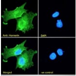 Immunofluorescence - Anti-Hornerin Antibody (A285984) - Antibodies.com
