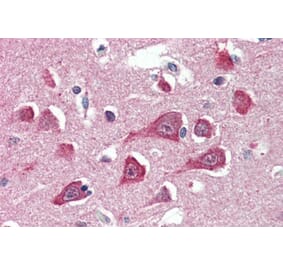 Immunohistochemistry - Anti-HRASLS3 Antibody (A285986) - Antibodies.com
