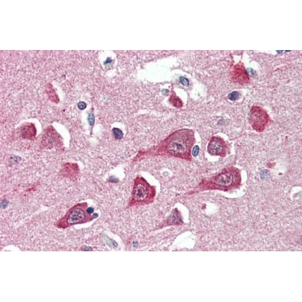 Immunohistochemistry - Anti-HRASLS3 Antibody (A285986) - Antibodies.com