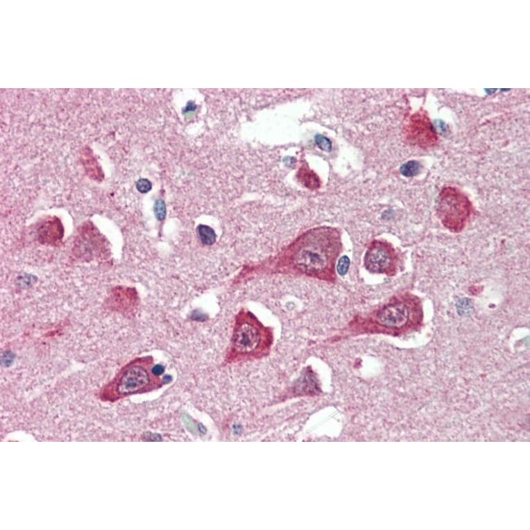 Immunohistochemistry - Anti-HRASLS3 Antibody (A285986) - Antibodies.com