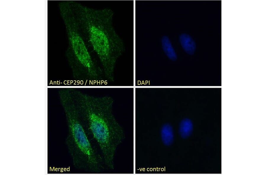 Immunofluorescence - Anti-CEP290 Antibody (A285988) - Antibodies.com