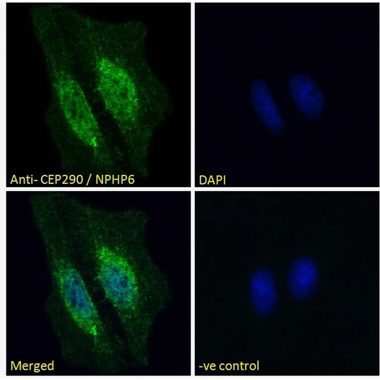 Immunofluorescence - Anti-CEP290 Antibody (A285988) - Antibodies.com