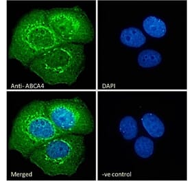 Immunofluorescence - Anti-ABCA4 Antibody (A285991) - Antibodies.com