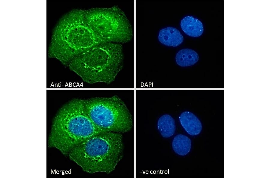 Immunofluorescence - Anti-ABCA4 Antibody (A285991) - Antibodies.com