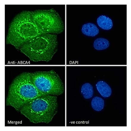 Immunofluorescence - Anti-ABCA4 Antibody (A285991) - Antibodies.com