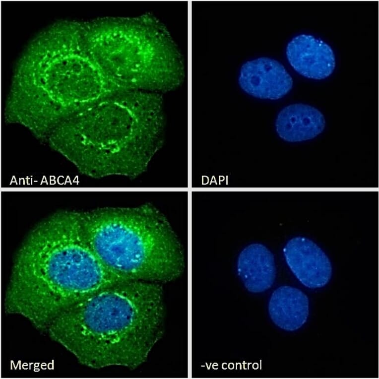 Immunofluorescence - Anti-ABCA4 Antibody (A285991) - Antibodies.com