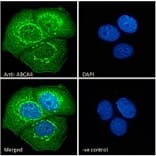 Immunofluorescence - Anti-ABCA4 Antibody (A285991) - Antibodies.com