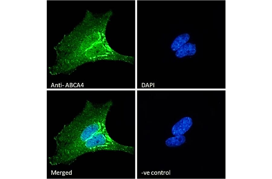 Immunofluorescence - Anti-ABCA4 Antibody (A285991) - Antibodies.com