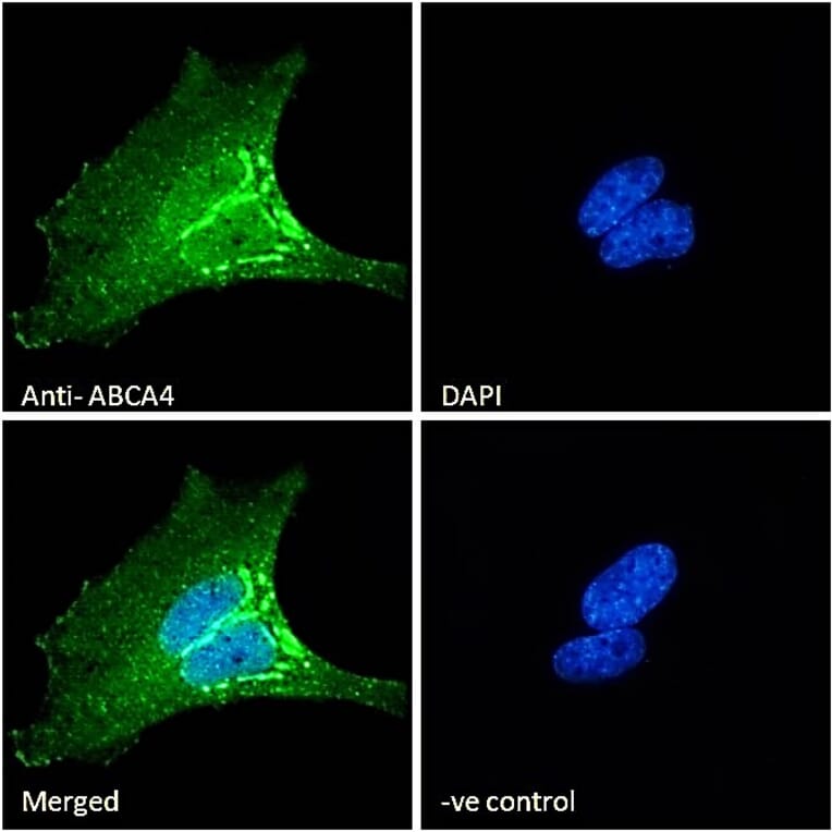 Immunofluorescence - Anti-ABCA4 Antibody (A285991) - Antibodies.com