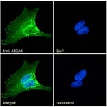 Immunofluorescence - Anti-ABCA4 Antibody (A285991) - Antibodies.com