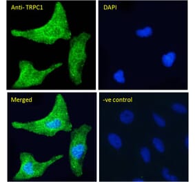 Immunofluorescence - Anti-TRPC1 Antibody (A285993) - Antibodies.com