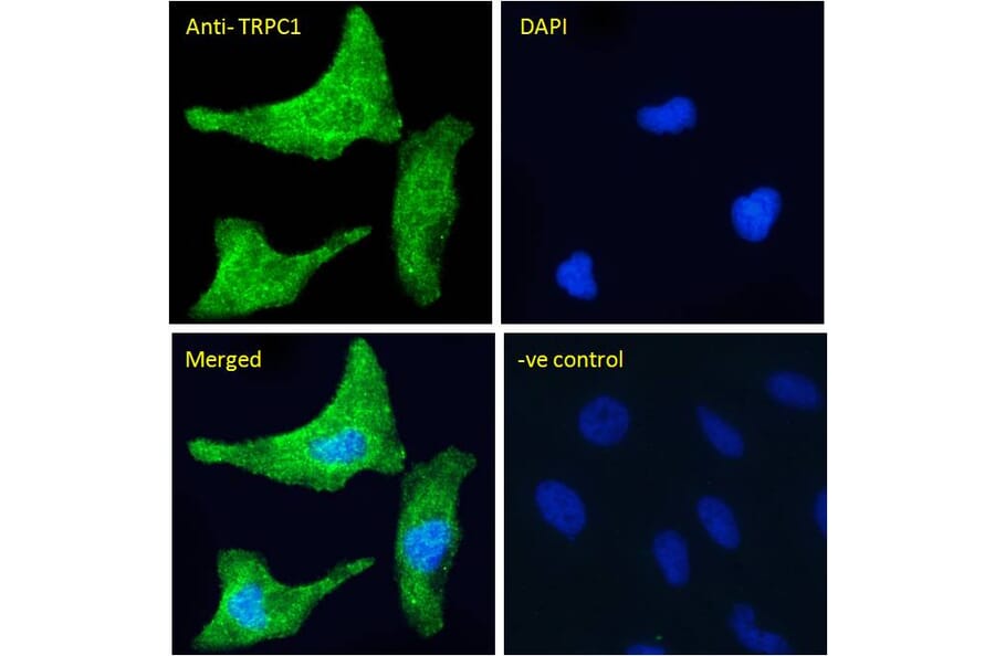 Immunofluorescence - Anti-TRPC1 Antibody (A285993) - Antibodies.com