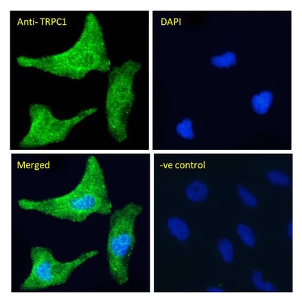 Immunofluorescence - Anti-TRPC1 Antibody (A285993) - Antibodies.com