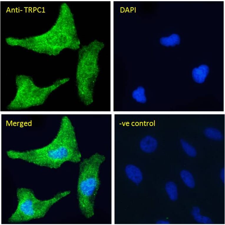 Immunofluorescence - Anti-TRPC1 Antibody (A285993) - Antibodies.com