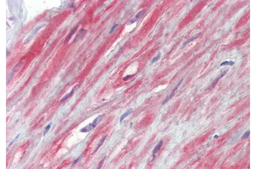 Immunohistochemistry - Anti-TRPC1 Antibody (A285993) - Antibodies.com