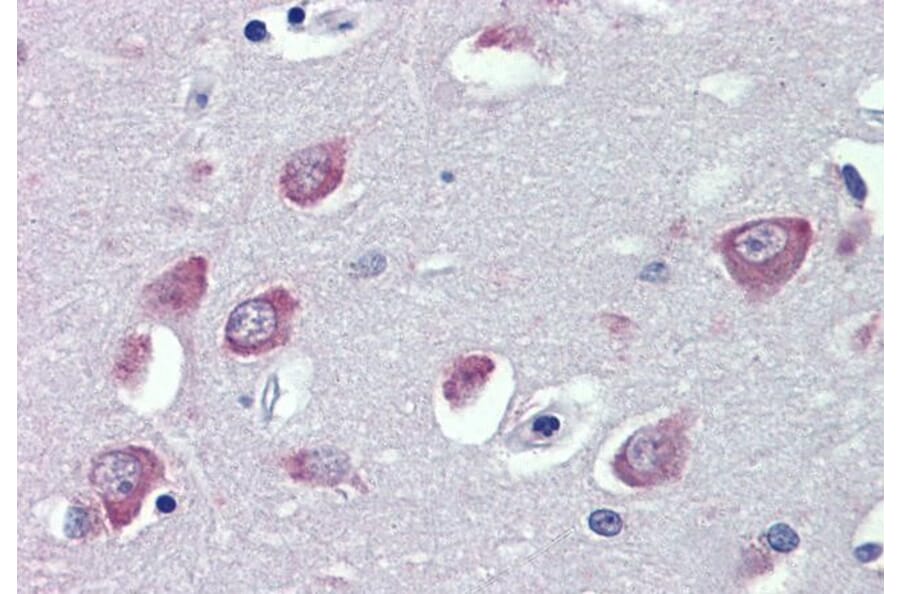 Immunohistochemistry - Anti-TRPC1 Antibody (A285993) - Antibodies.com