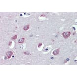 Immunohistochemistry - Anti-TRPC1 Antibody (A285993) - Antibodies.com