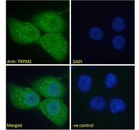 Immunofluorescence - Anti-TRPM2 Antibody (A285994) - Antibodies.com