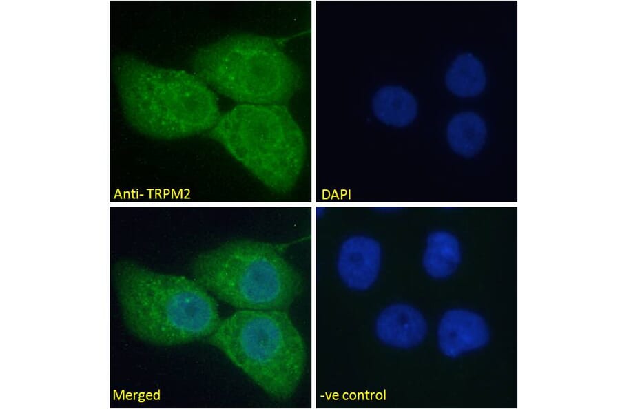 Immunofluorescence - Anti-TRPM2 Antibody (A285994) - Antibodies.com