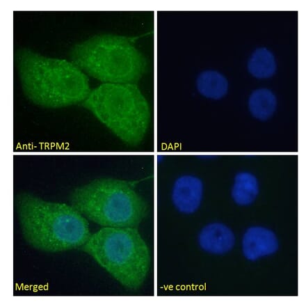 Immunofluorescence - Anti-TRPM2 Antibody (A285994) - Antibodies.com