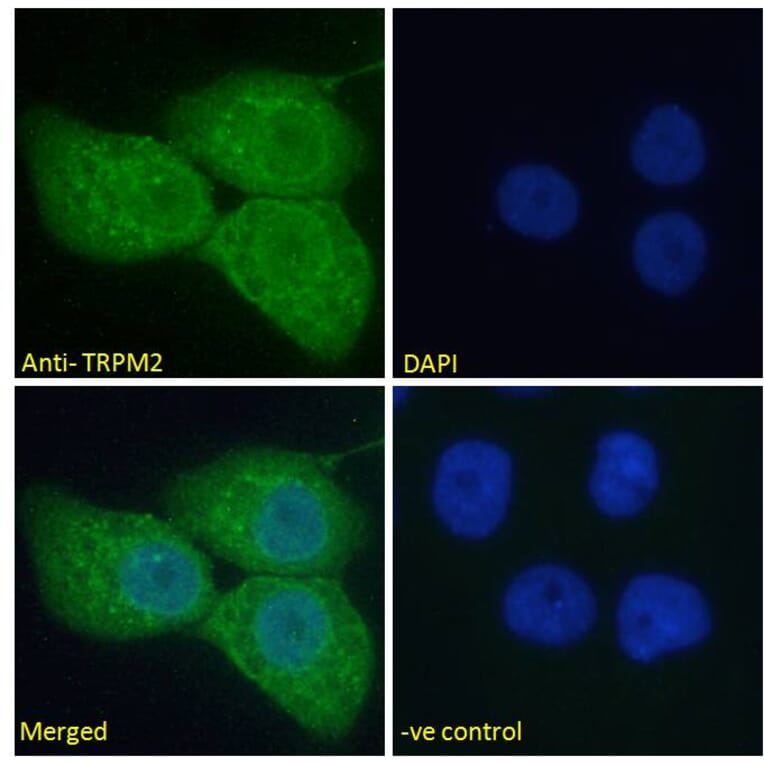 Immunofluorescence - Anti-TRPM2 Antibody (A285994) - Antibodies.com