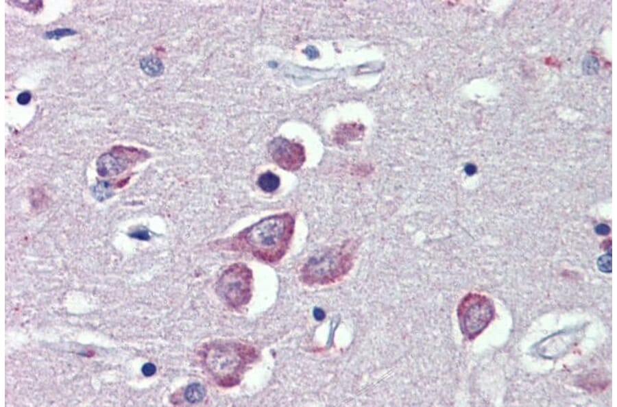 Immunohistochemistry - Anti-TRPM2 Antibody (A285994) - Antibodies.com