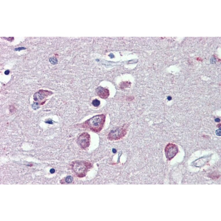 Immunohistochemistry - Anti-TRPM2 Antibody (A285994) - Antibodies.com
