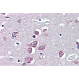Immunohistochemistry - Anti-TRPM2 Antibody (A285994) - Antibodies.com