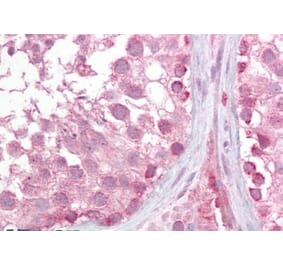 Immunohistochemistry - Anti-LMX1b Antibody (A285995) - Antibodies.com