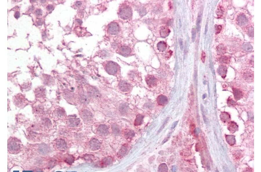 Immunohistochemistry - Anti-LMX1b Antibody (A285995) - Antibodies.com