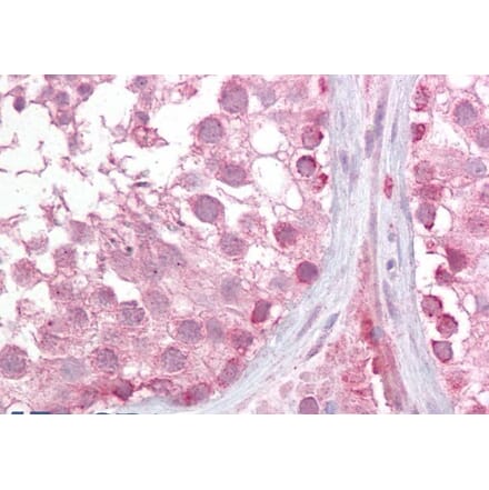 Immunohistochemistry - Anti-LMX1b Antibody (A285995) - Antibodies.com